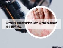 兰州治疗皮肤病哪个医院好 兰州治疗皮肤病哪个医院好点