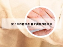 背上长白色斑点 背上面有白色斑点