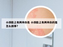 小孩脸上有两块白色 小孩脸上有两块白的是怎么回事?