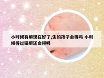 小时候有癣现在好了,生的孩子会得吗 小时候得过猫癣还会得吗