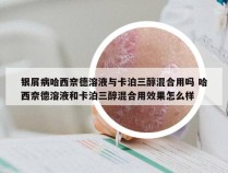 银屑病哈西奈德溶液与卡泊三醇混合用吗 哈西奈德溶液和卡泊三醇混合用效果怎么样