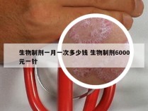 生物制剂一月一次多少钱 生物制剂6000元一针
