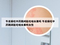 牛皮癣吃中药期间能吃啥水果吗 牛皮癣吃中药期间能吃啥水果吗女性