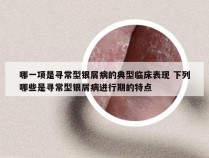 哪一项是寻常型银屑病的典型临床表现 下列哪些是寻常型银屑病进行期的特点
