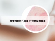 打生物制剂扎哪里 打生物制剂作用