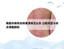 嘴唇内侧有白斑像溃疡怎么办 口腔内壁小白点像脂肪粒