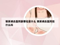 银屑病去医院都要检查什么 银屑病去医院挂什么科