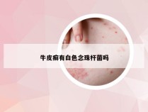 牛皮癣有白色念珠杆菌吗
