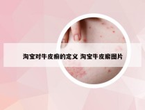 淘宝对牛皮癣的定义 淘宝牛皮廨图片