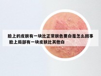 脸上的皮肤有一块比正常肤色要白是怎么回事 脸上局部有一块皮肤比其他白