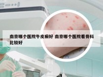 南京哪个医院牛皮癣好 南京哪个医院看骨科比较好