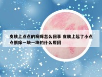 皮肤上点点的癣痒怎么回事 皮肤上起了小点点很痒一块一块的什么原因