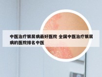 中医治疗银屑病最好医院 全国中医治疗银屑病的医院排名中医