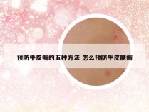 预防牛皮癣的五种方法 怎么预防牛皮肤癣