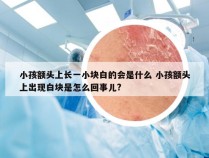 小孩额头上长一小块白的会是什么 小孩额头上出现白块是怎么回事儿?