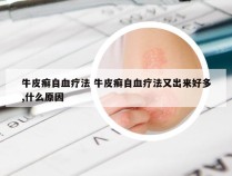 牛皮癣自血疗法 牛皮癣自血疗法又出来好多,什么原因