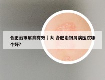 合肥治银屑病有效軍大 合肥治银屑病医院哪个好?