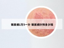 银屑病1万5一针 银屑病针剂多少钱