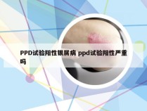 PPD试验阳性银屑病 ppd试验阳性严重吗