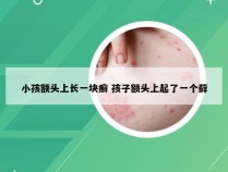 小孩额头上长一块癣 孩子额头上起了一个藓