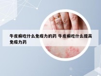 牛皮癣吃什么免疫力的药 牛皮癣吃什么提高免疫力药