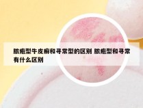 脓疱型牛皮癣和寻常型的区别 脓疱型和寻常有什么区别
