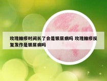 玫瑰糠疹时间长了会是银屑病吗 玫瑰糠疹反复发作是银屑病吗