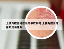 土楼万应膏可以治疗牛皮癣吗 土楼万应膏抑菌的是治什么