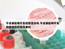 牛皮癣能喝牛鱼胶原蛋白吗 牛皮癣能喝牛鱼胶原蛋白吗有效果吗