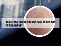 北京市哪家医院看皮肤病最权威 北京哪家医院看皮肤病好?