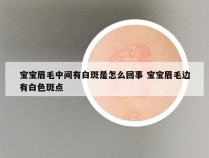 宝宝眉毛中间有白斑是怎么回事 宝宝眉毛边有白色斑点