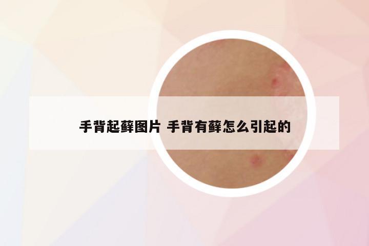 手背起藓图片 手背有藓怎么引起的