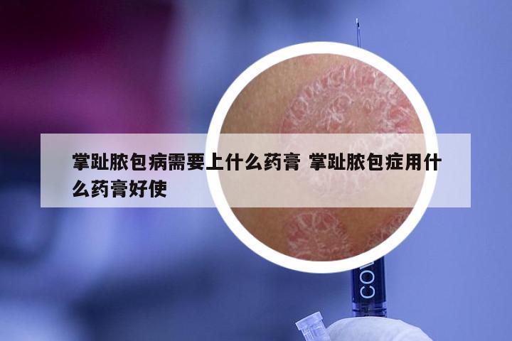 掌趾脓包病需要上什么药膏 掌趾脓包症用什么药膏好使