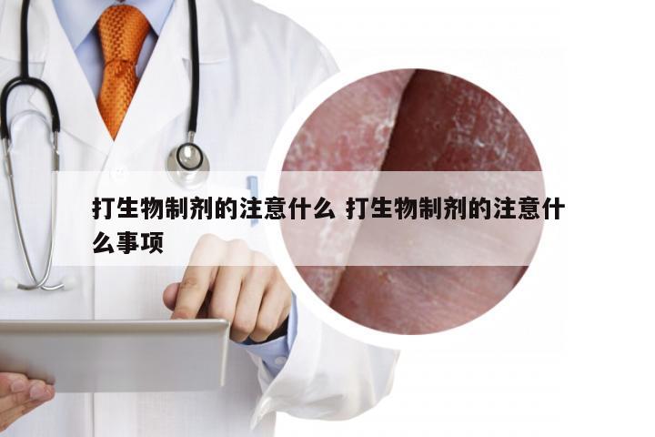 打生物制剂的注意什么 打生物制剂的注意什么事项