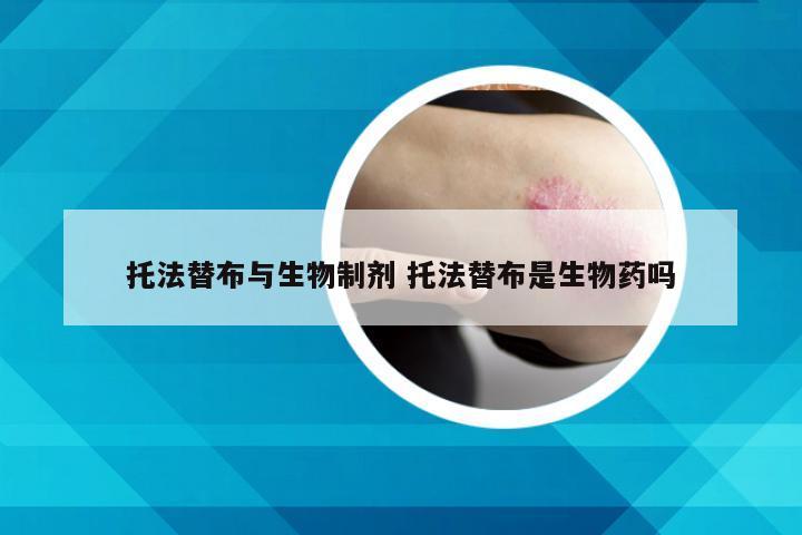 托法替布与生物制剂 托法替布是生物药吗