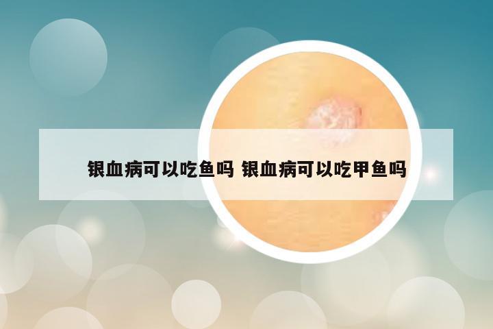 银血病可以吃鱼吗 银血病可以吃甲鱼吗