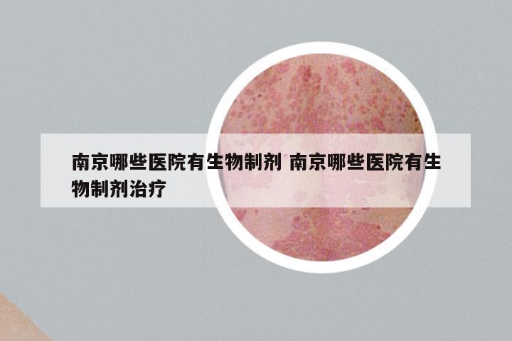 南京哪些医院有生物制剂 南京哪些医院有生物制剂治疗