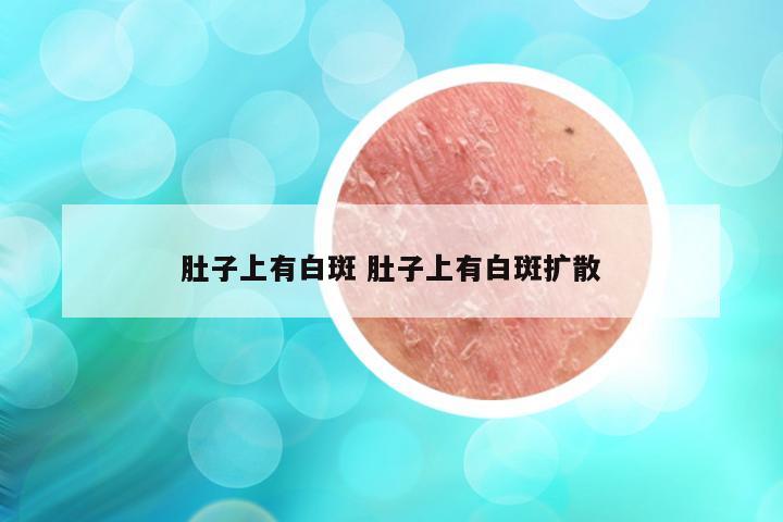 肚子上有白斑 肚子上有白斑扩散