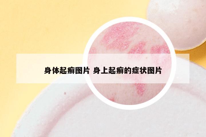 身体起癣图片 身上起癣的症状图片