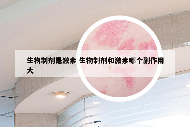 生物制剂是激素 生物制剂和激素哪个副作用大