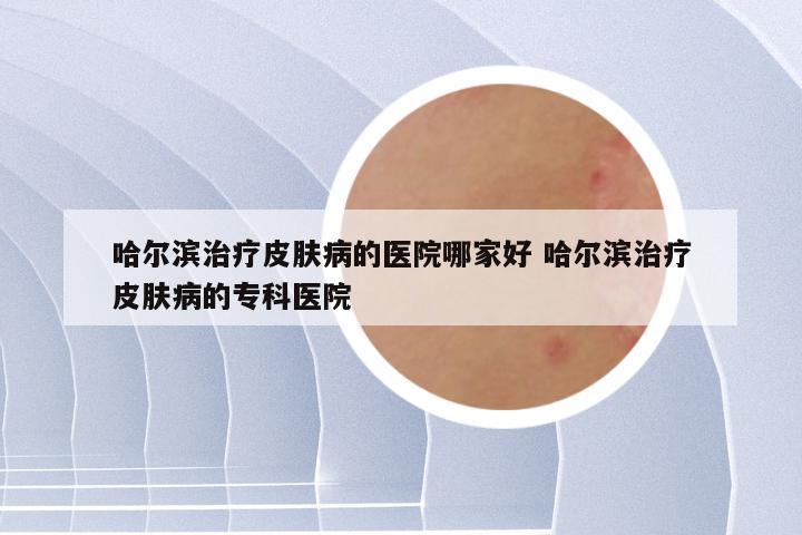哈尔滨治疗皮肤病的医院哪家好 哈尔滨治疗皮肤病的专科医院