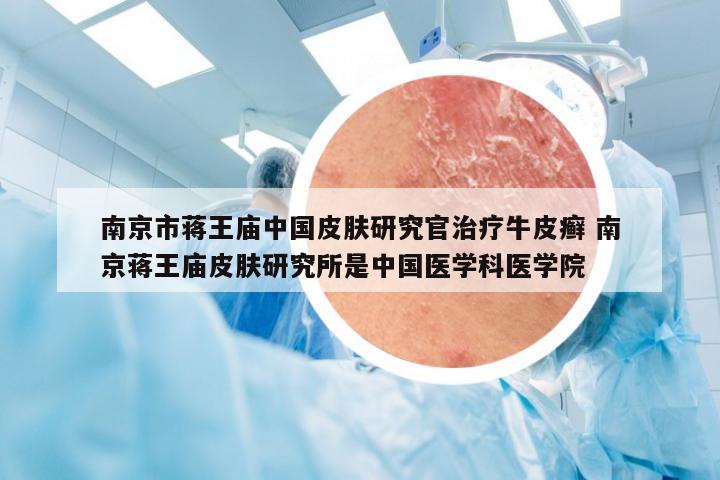 南京市蒋王庙中国皮肤研究官治疗牛皮癣 南京蒋王庙皮肤研究所是中国医学科医学院