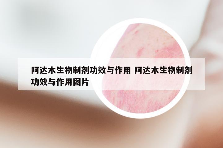 阿达木生物制剂功效与作用 阿达木生物制剂功效与作用图片