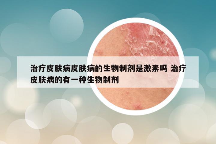 治疗皮肤病皮肤病的生物制剂是激素吗 治疗皮肤病的有一种生物制剂