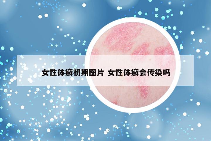女性体癣初期图片 女性体癣会传染吗