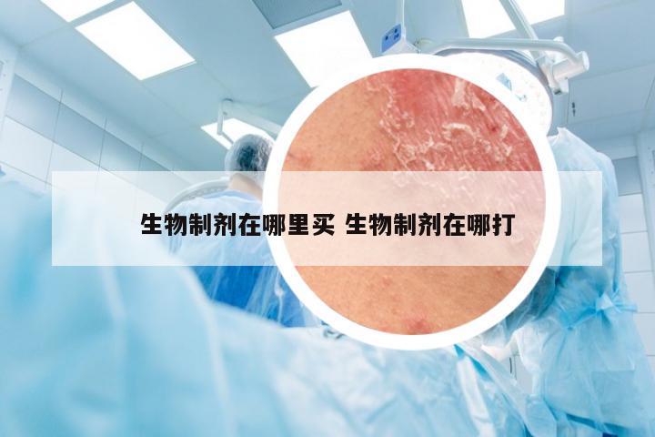 生物制剂在哪里买 生物制剂在哪打