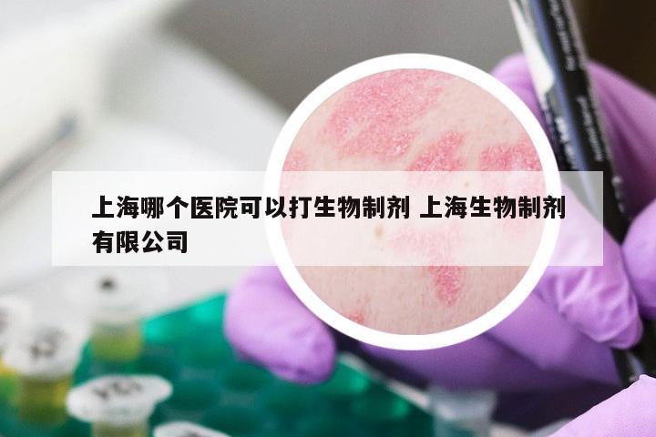 上海哪个医院可以打生物制剂 上海生物制剂有限公司