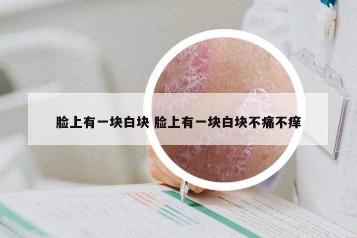 脸上有一块白块 脸上有一块白块不痛不痒