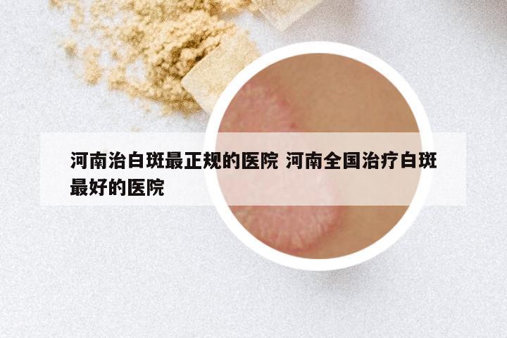 河南治白斑最正规的医院 河南全国治疗白斑最好的医院