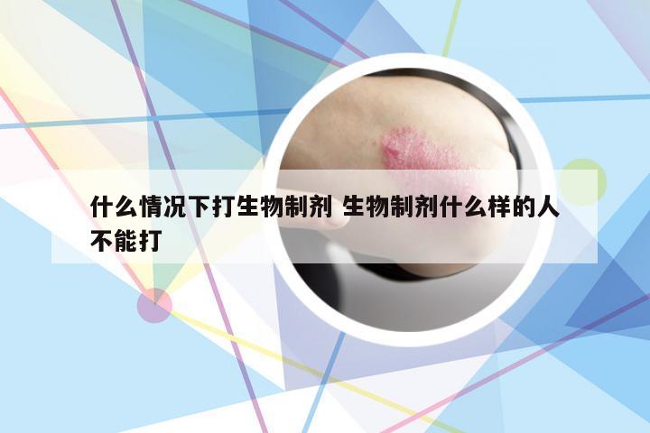 什么情况下打生物制剂 生物制剂什么样的人不能打